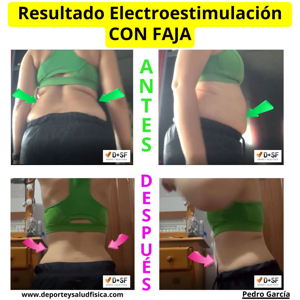 perder peso con electroestimulación
