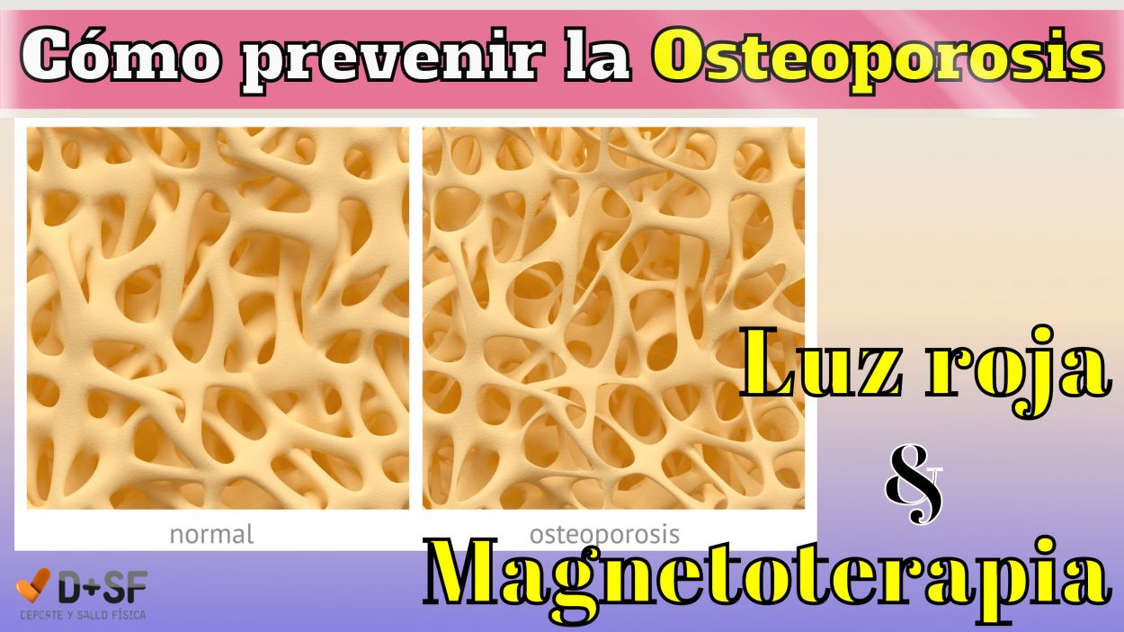 tratamiento osteoporosis severa con Magnetoterapia y luz roja