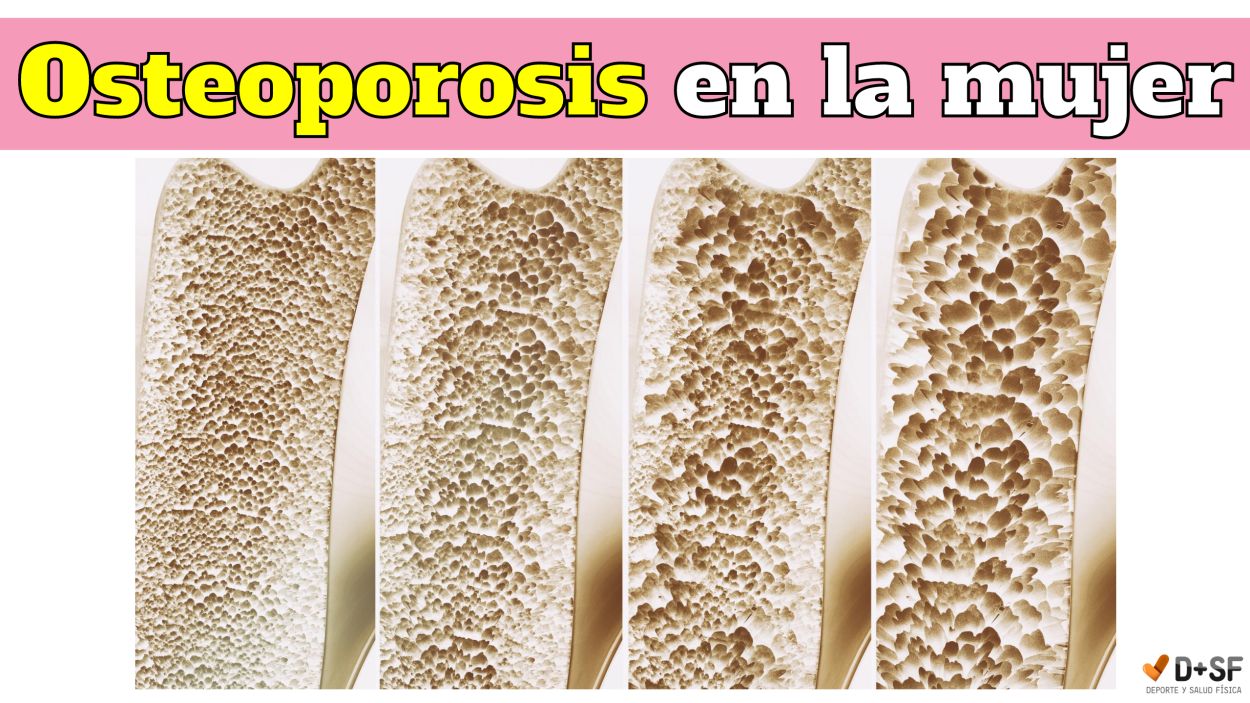 como curar la osteoporosis con terapia de luz roja y magnetoterapia