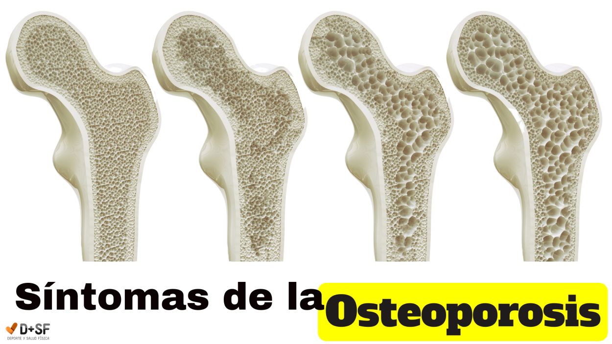 osteoporosis y magnetoterapia. Síntomas de la osteoporosis